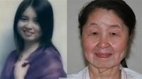 二十八岁女子得怪病变老奶奶