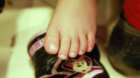 幼儿园50儿童指甲离奇断裂