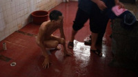 被关铁笼8年男子无法行走