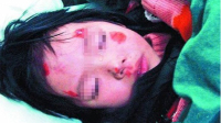 吸毒男子发狂摔死亲生幼女
