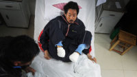 安徽男子无钱治病自锯脚