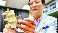 3D打印技术或引发"医疗改革"