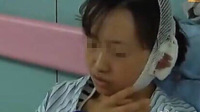 大妈护狗心切咬断女孩左耳