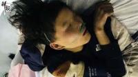 15岁少年吃辣条险丧命